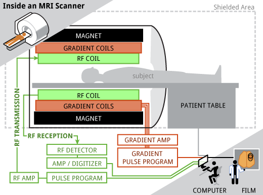 Inside an MRI Scanner
