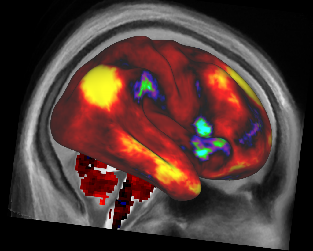 /news/2013/03/FunctionalConnectivity_RightHemisphere_Parietal-1024x819.png