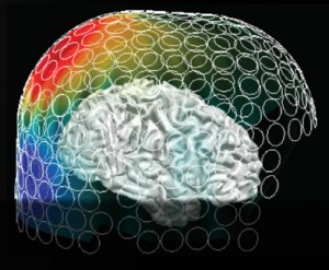 An example activation pattern from an MEG cortical sheet